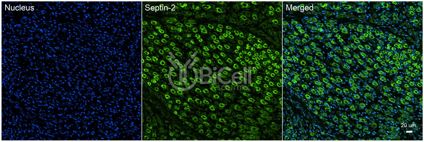SEPTIN2 (SEPT2 or NEDD5) Antibody - FFPE Validated