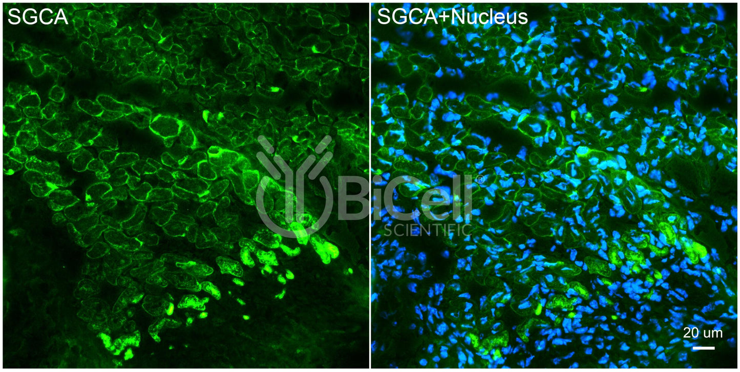 Sarcoglycan Alpha (SGCA) Antibody - FFPE Validated