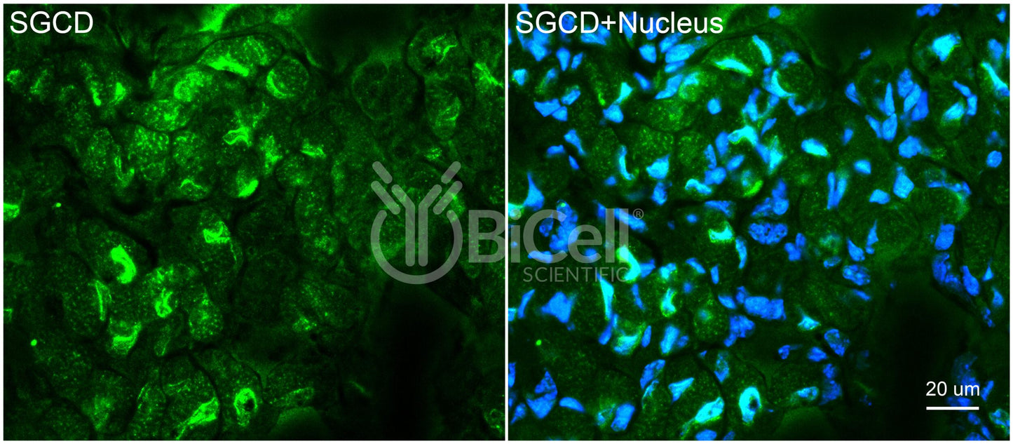 Sarcoglycan Delta (SGCD) Antibody