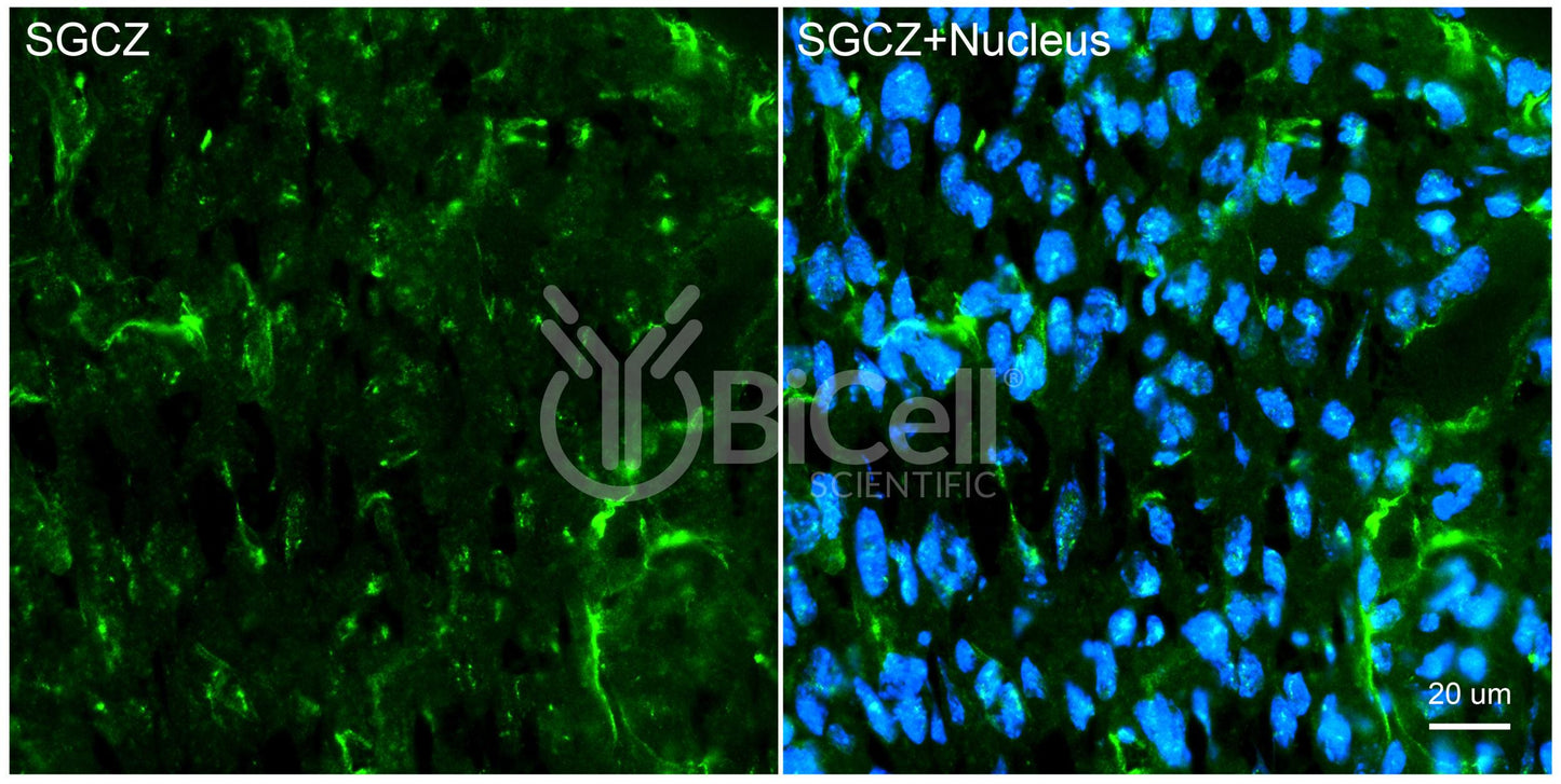 Sarcoglycan Zeta (SGCZ) Antibody