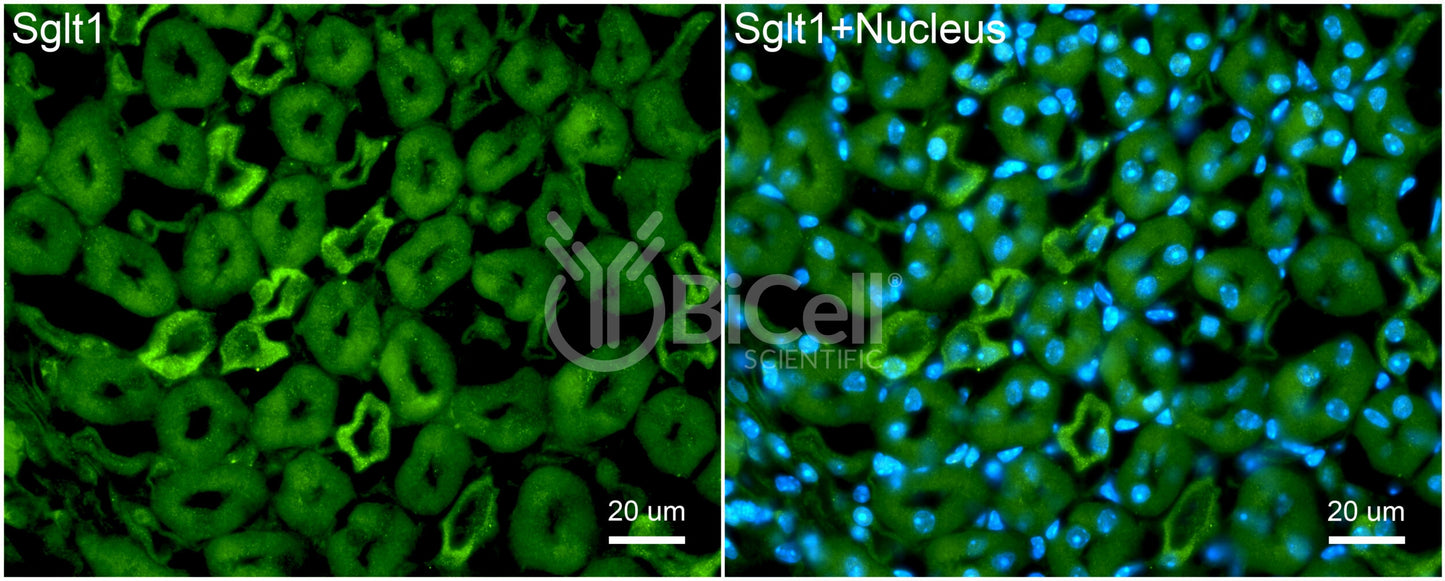 SGLT1 (Slc5a1) Antibody - Western Blot Validated