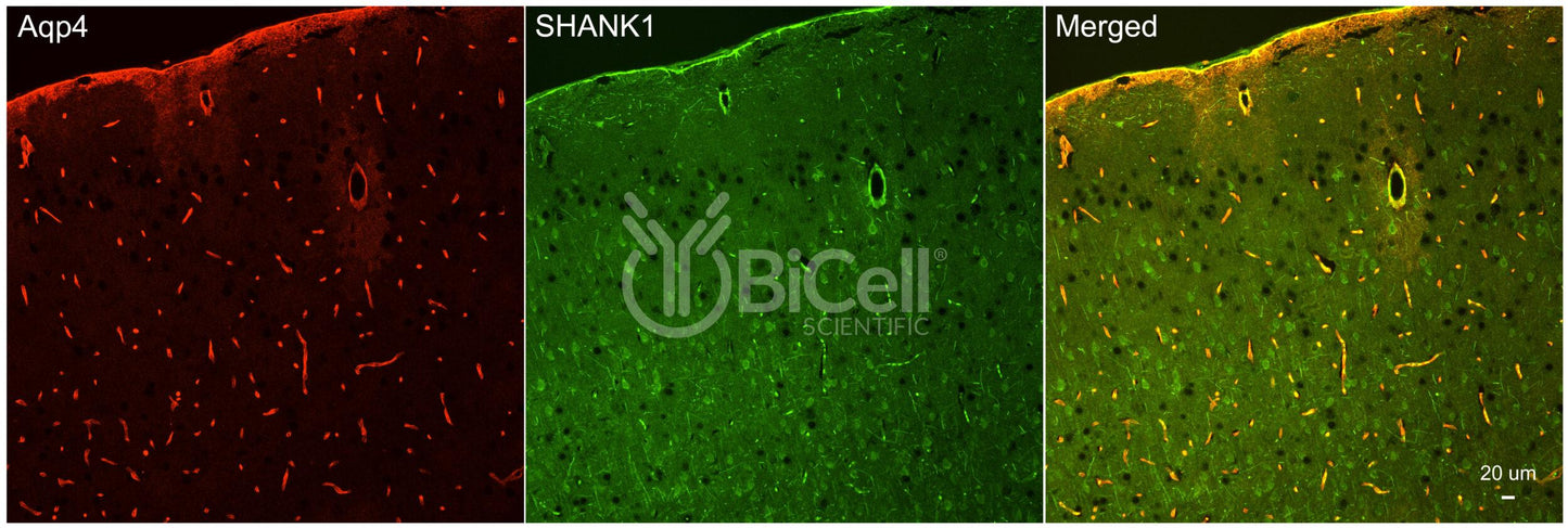 SHANK1 (Synamon) Antibody - FFPE Validated