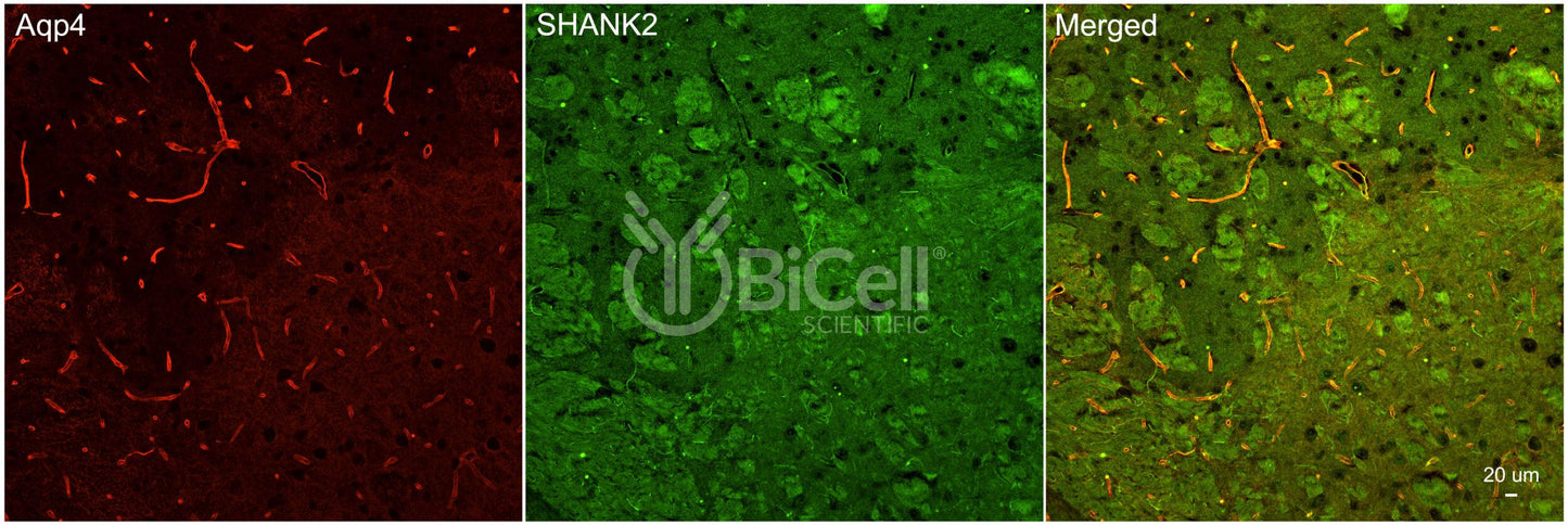SHANK2 Antibody