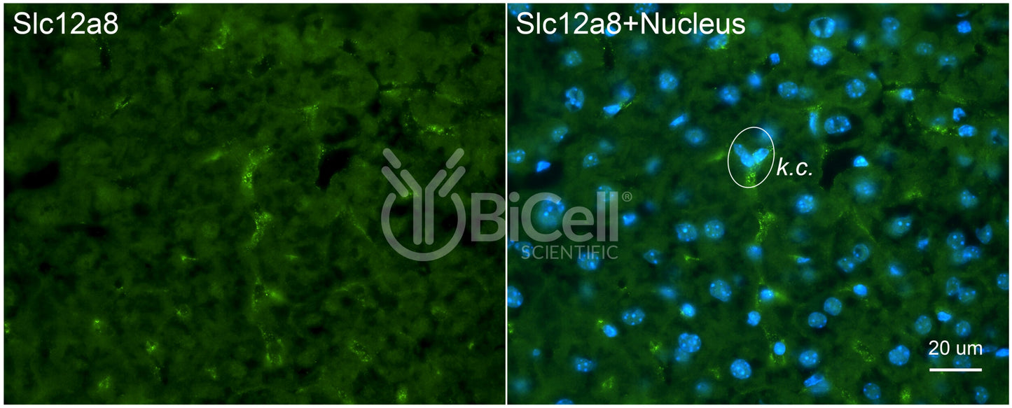 SLC12A8 (CCC9) Antibody - Western Blot Validated