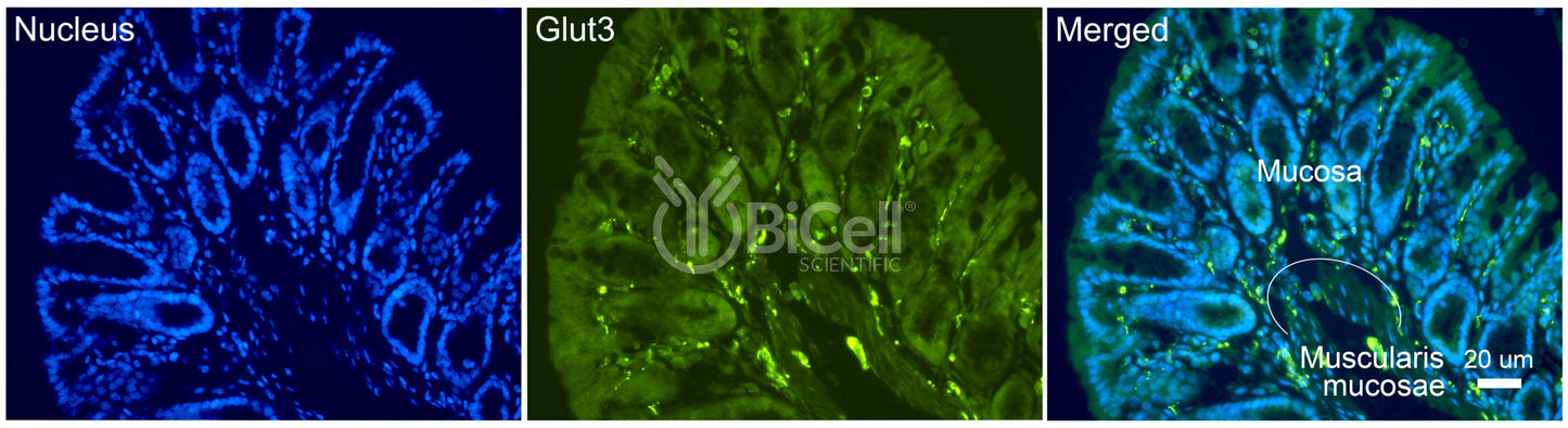 GLUT3 (SLC2A3) Antibody
