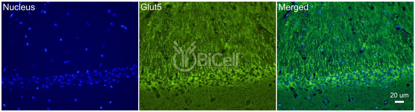 GLUT5 (SLC2A5) Antibody - FFPE Validated