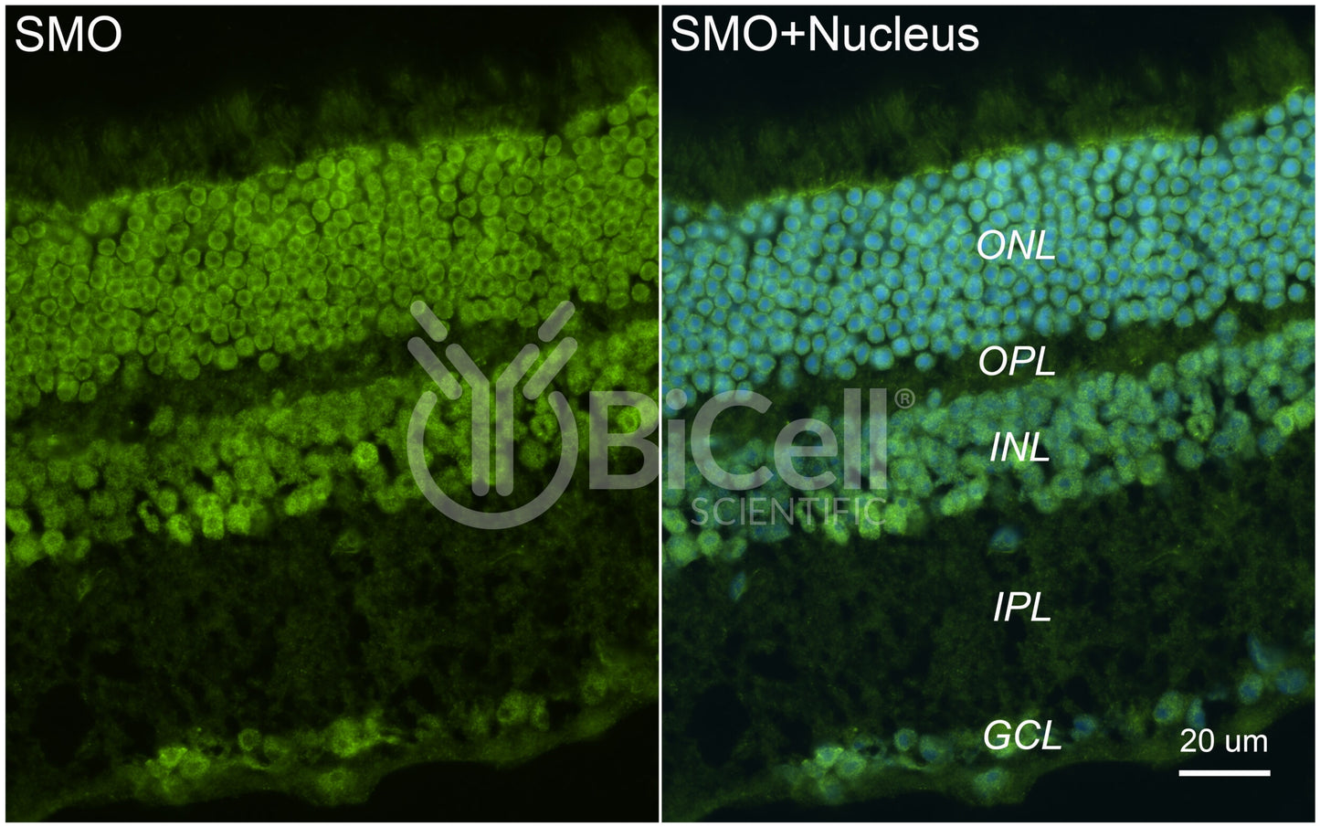 Smoothened (SMO or Frizzled-11 or FZD11) Antibody - FFPE Validated