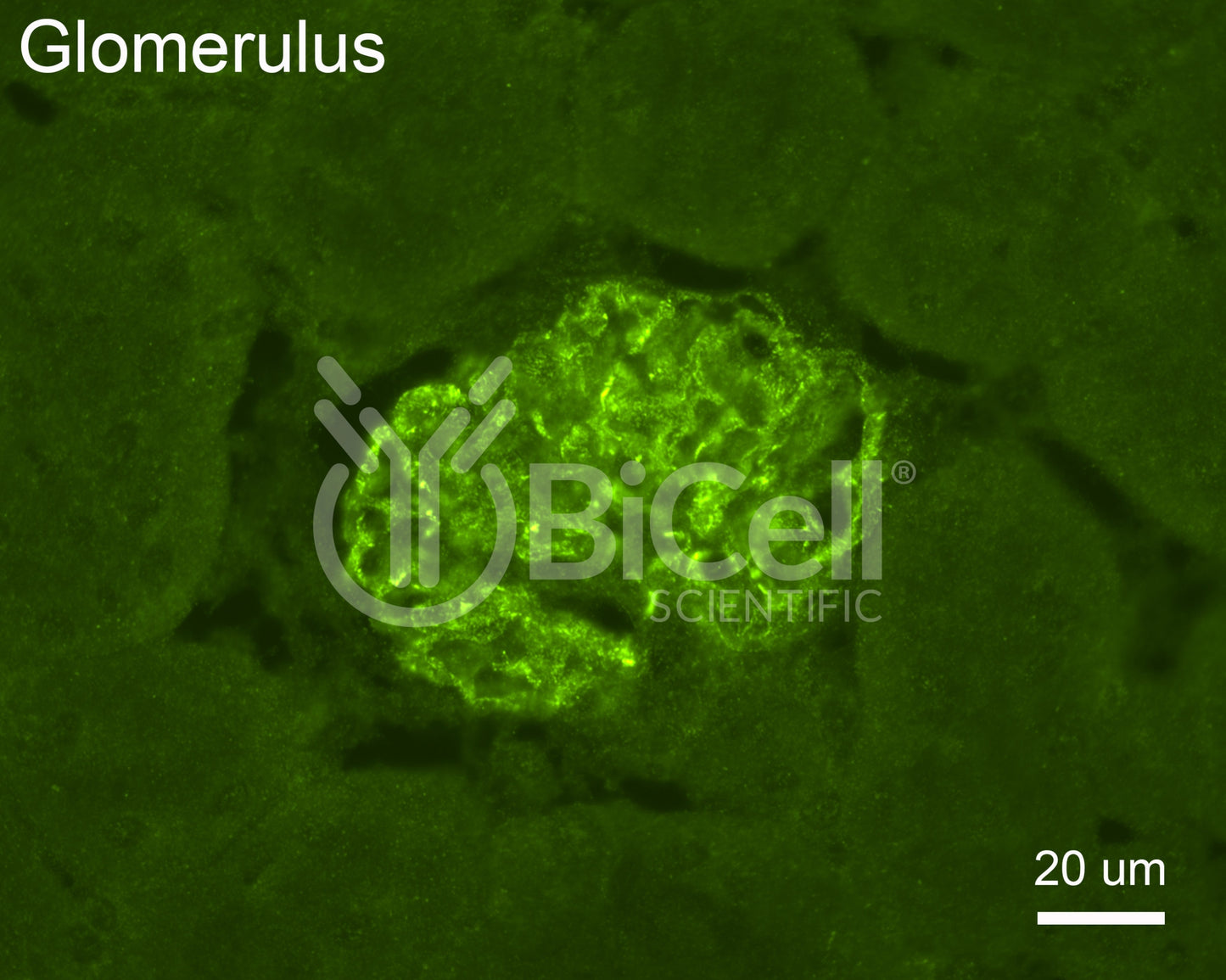Synaptopodin (SYNPO) Antibody - FFPE Validated