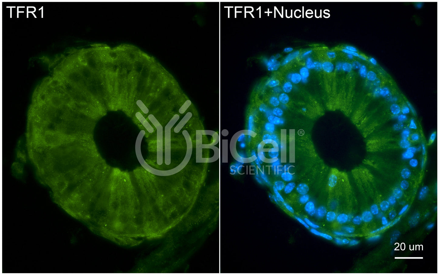 TFRC (TFR1 or CD71) Antibody