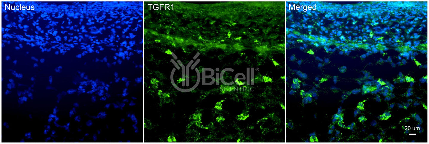 TGFBR1 (TGFR1) Antibody - Western Blot Validated