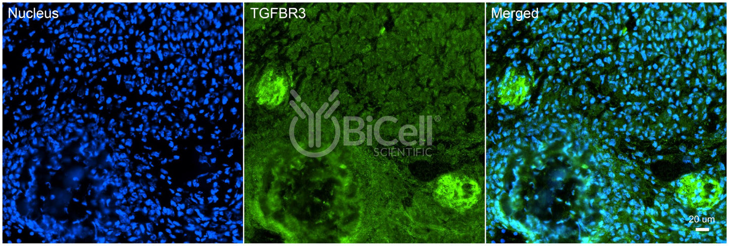 TGFBR3 Antibody