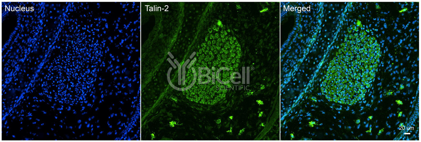 Talin-2 (TLN2) Antibody - FFPE Validated