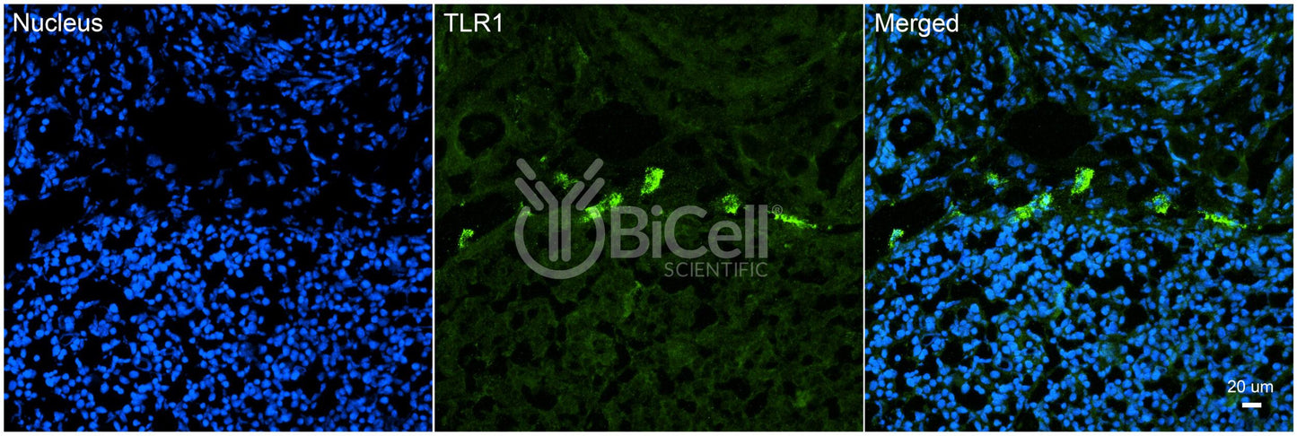 Toll-like receptor 1 (TLR1 or CD281) Antibody - FFPE Validated