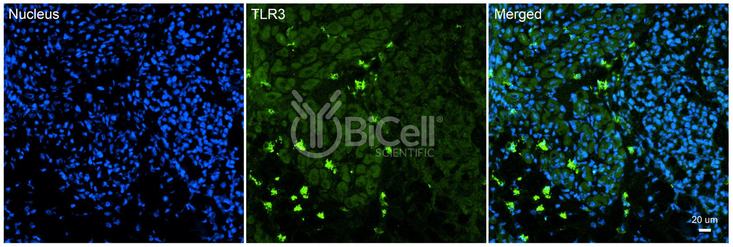 Toll-like receptor 3 (TLR3 or CD283) Antibody - FFPE Validated