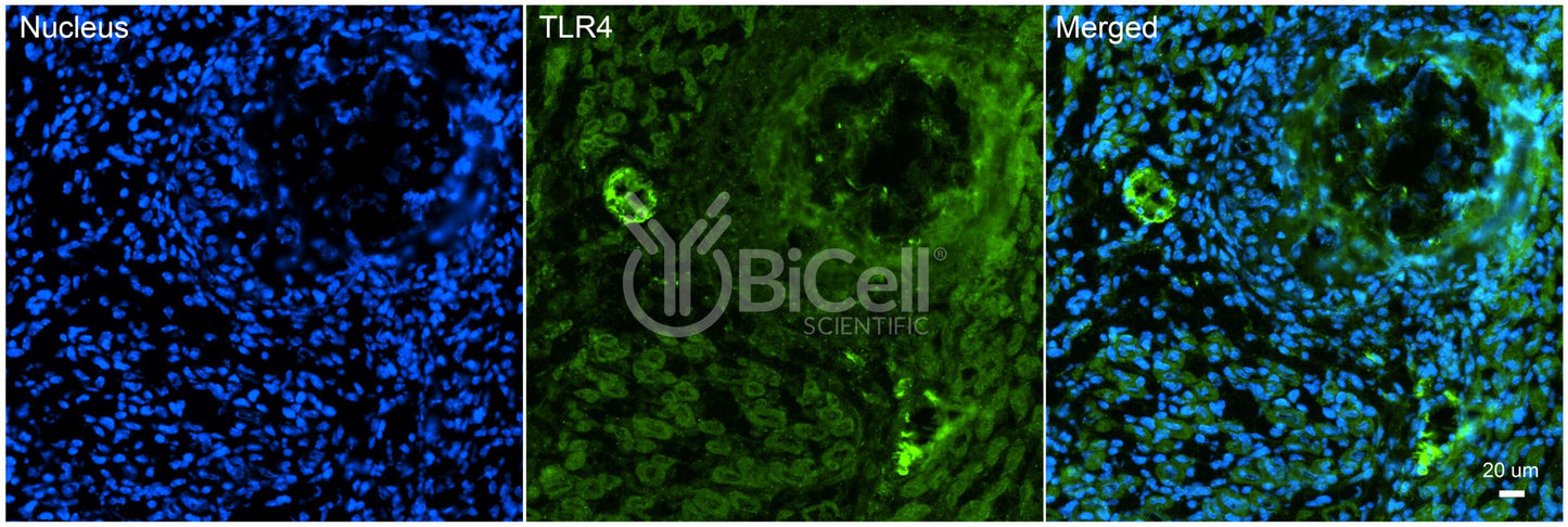 Toll-like receptor 4 (TLR4 or CD284) Antibody - FFPE Validated