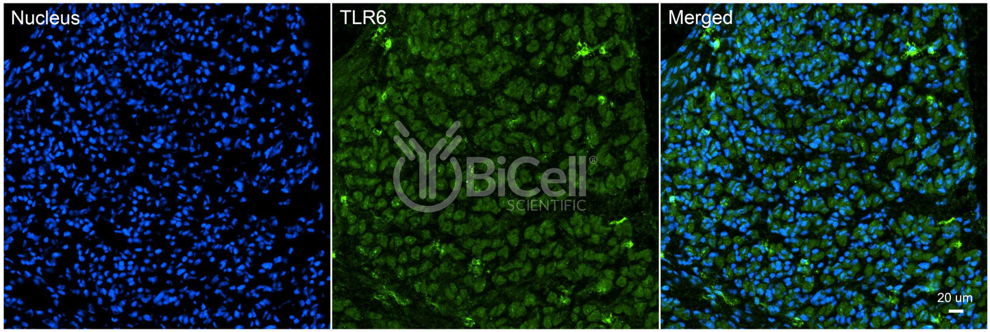 Toll-like receptor 6 (TLR6 or CD286) Antibody - FFPE Validated