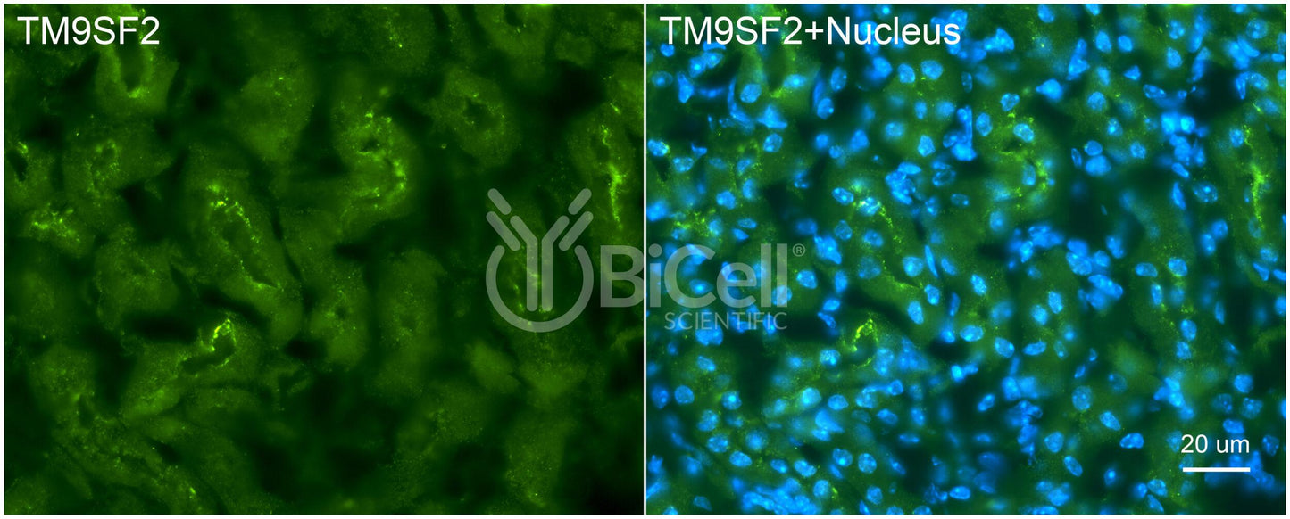 TM9SF2 Antibody - Western Blot Validated