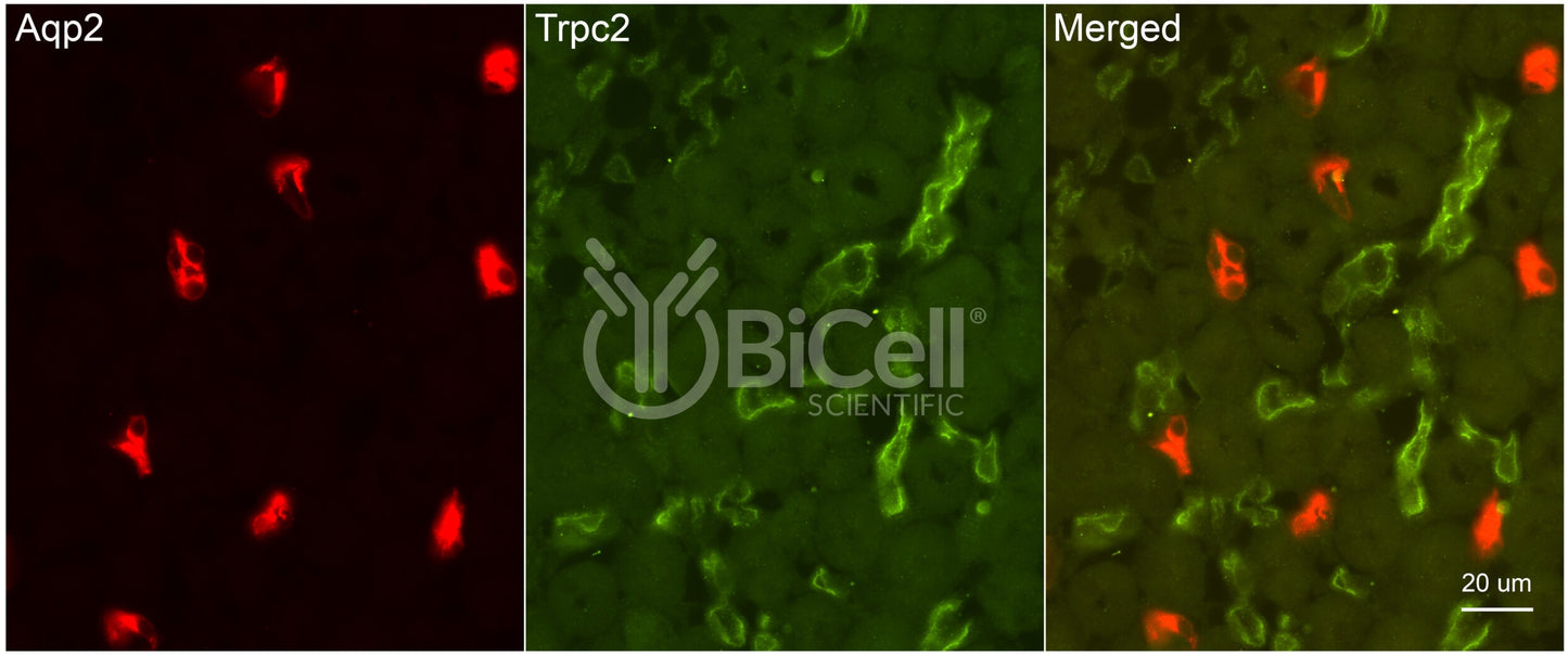 Trpc2 Antibody - FFPE Validated