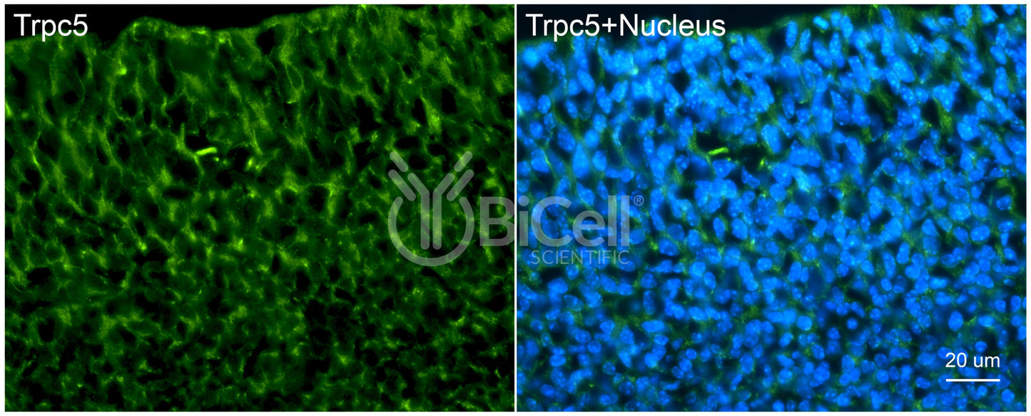 Trpc5 (C-Terminus) Antibody - Western Blot Validated