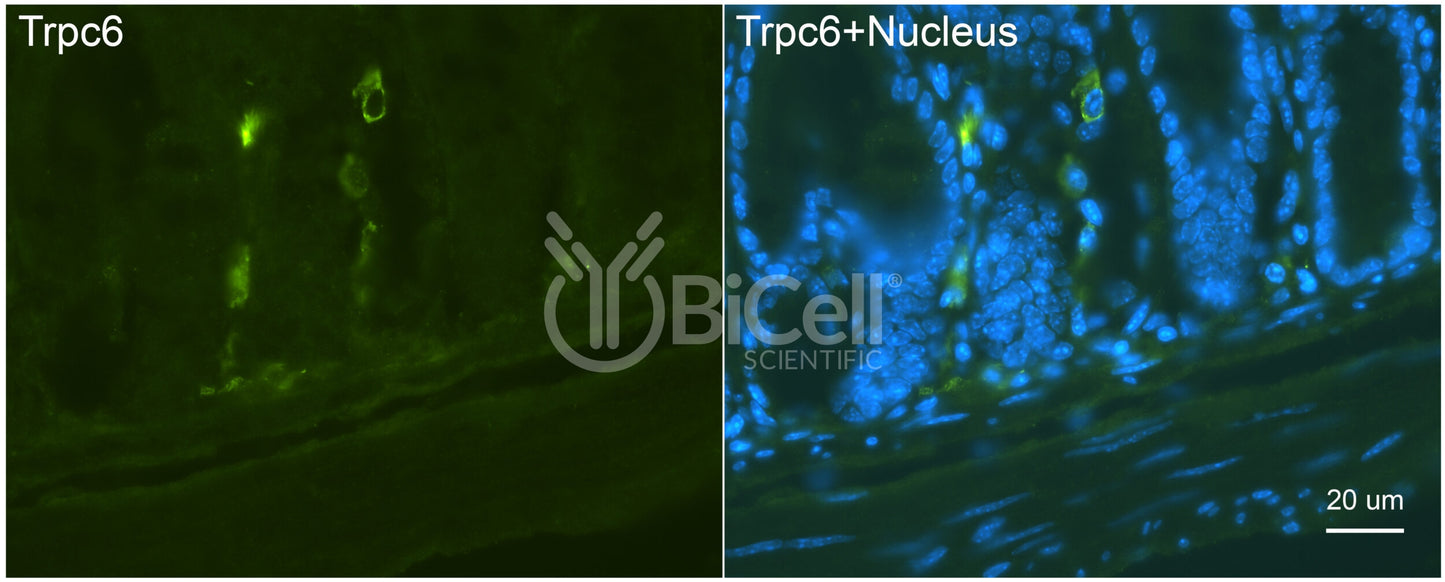 Trpc6 (C-Terminus) Antibody - FFPE Validated