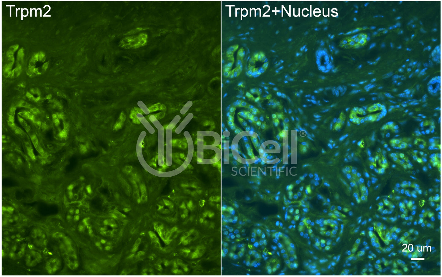 Trpm2 Antibody - Western Blot Validated