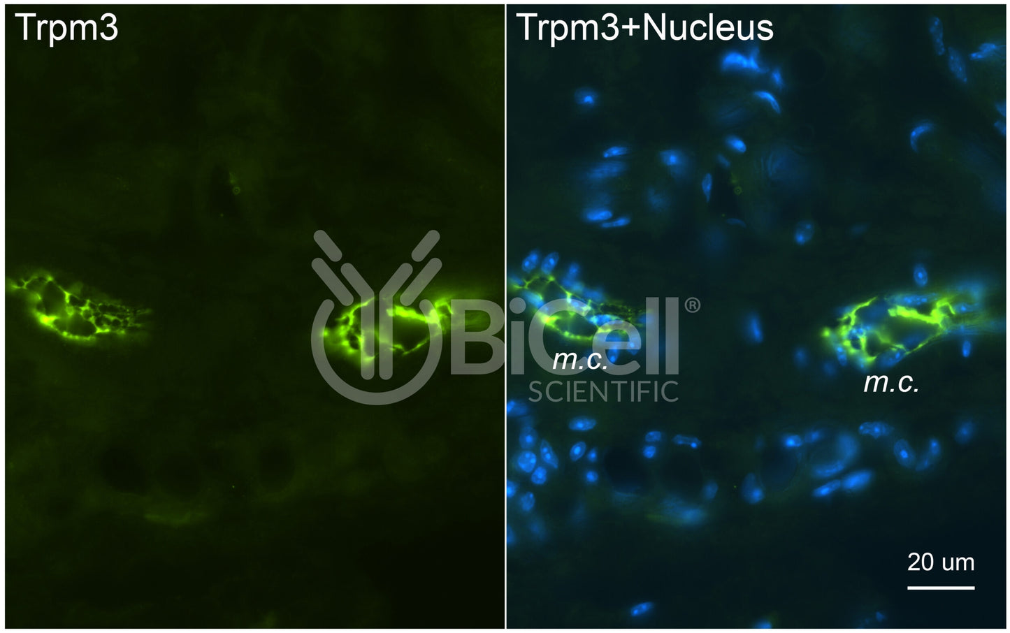 Trpm3 Antibody - FFPE Validated