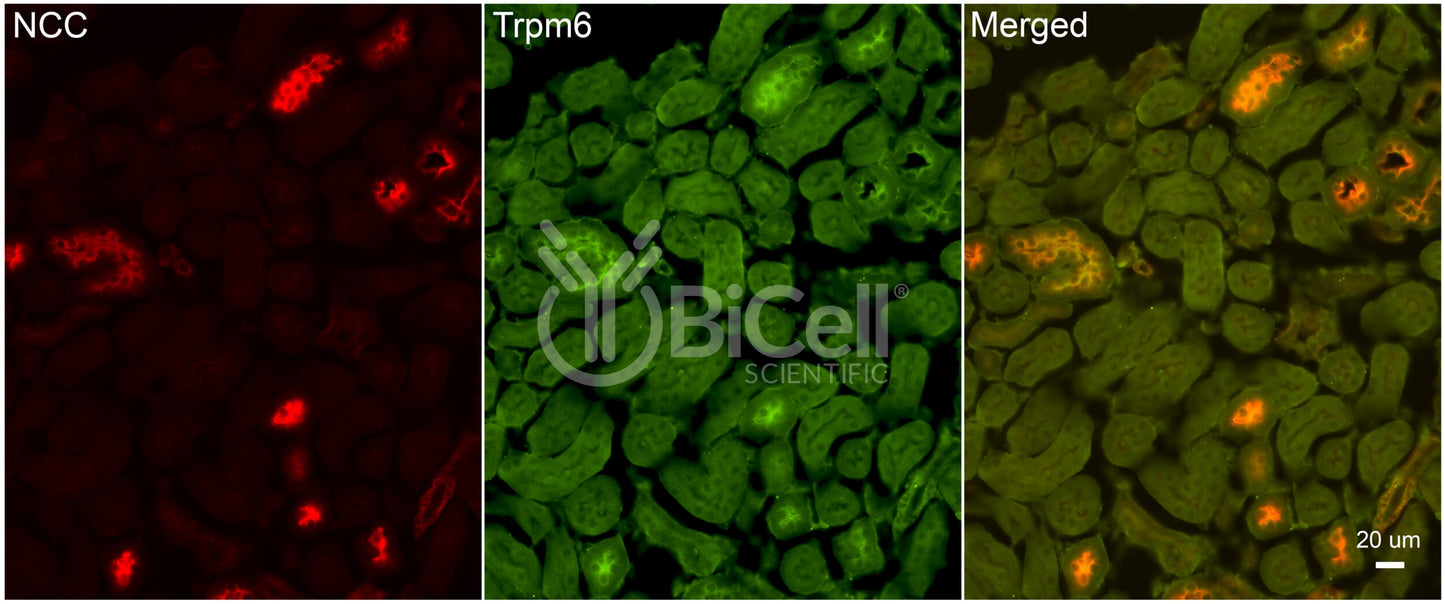 Trpm6 Antibody - FFPE Validated