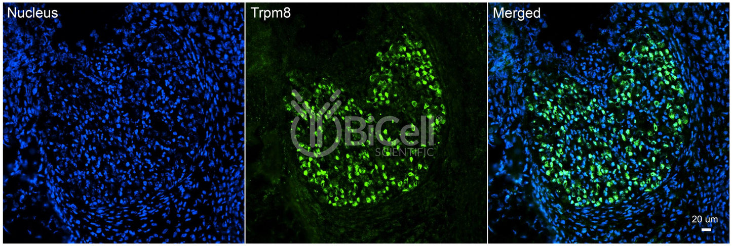 Trpm8 Antibody - FFPE Validated