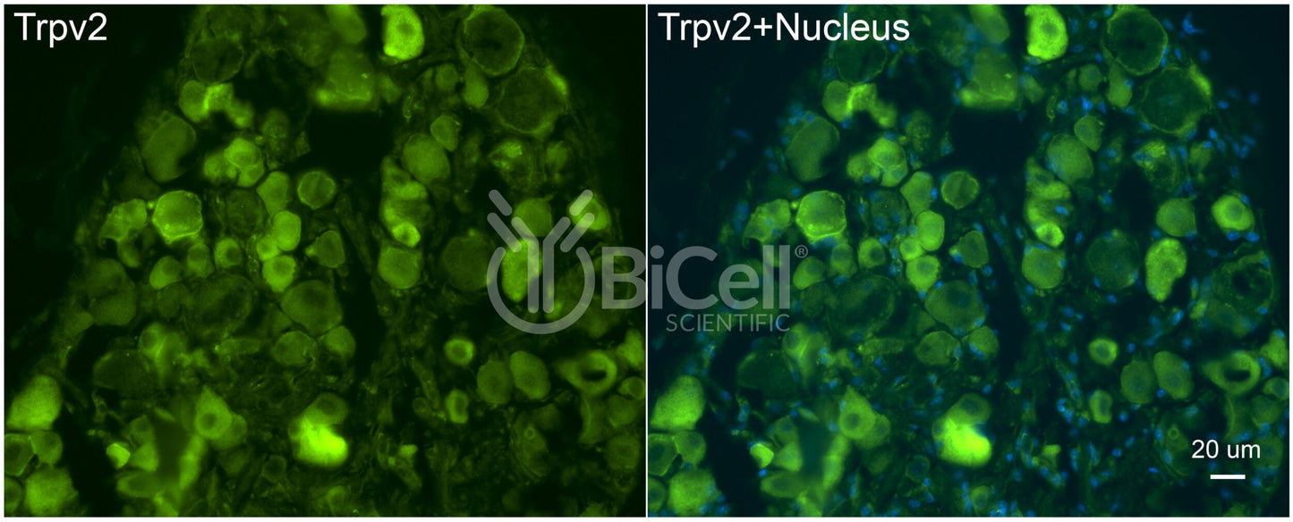 Trpv2 Antibody - Western Blot Validated
