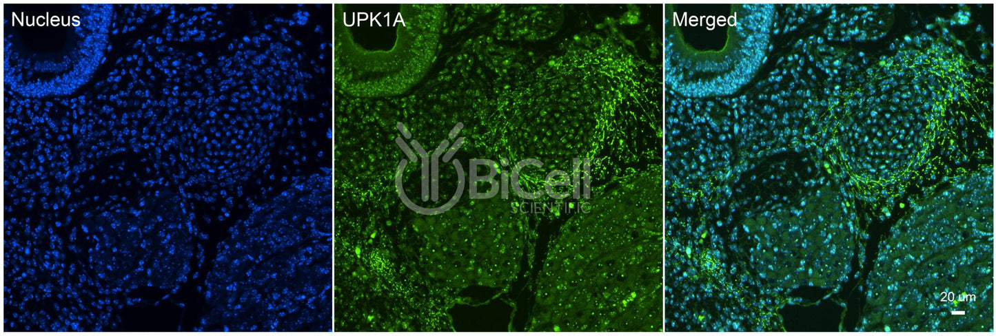 Tetraspanin-21 (TSPAN21 or Uroplakin-1a or UPK1A or UPKA) Antibody - FFPE Validated