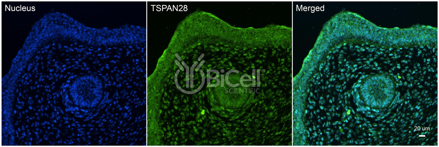 Tetraspanin-28 (TSPAN28 or CD81) Antibody