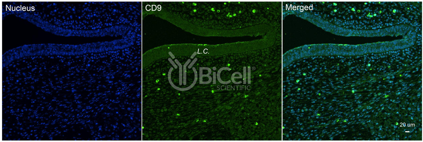 Tetraspanin-29 (TSPAN29 or CD9) Antibody