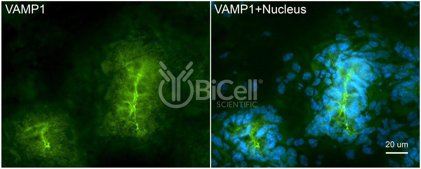 VAMP1 (SYB1) HiRe Antibody - FFPE Validated