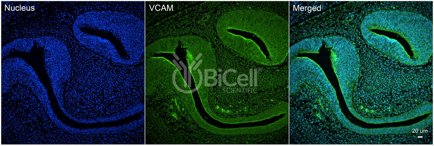 VCAM1 (CD106) Antibody - FFPE Validated