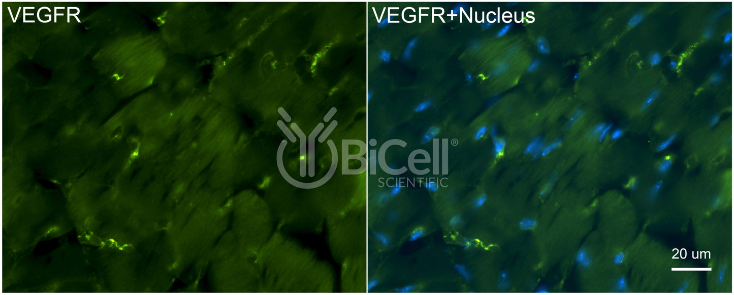 VEGFR1 (FLT1) Antibody - Western Blot Validated
