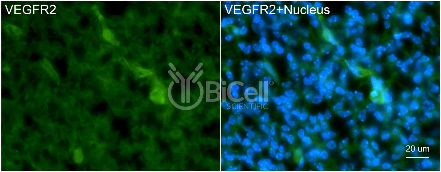 VEGFR2 (KDR or FLK1 or CD309) Antibody - FFPE Validated