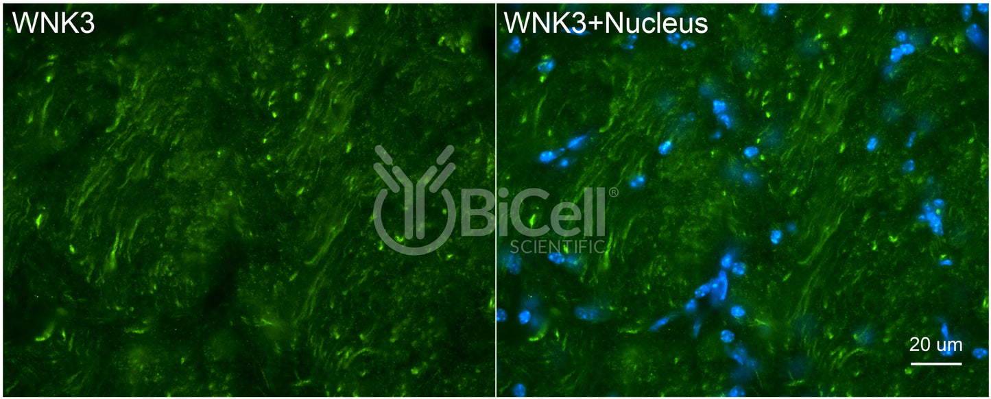 WNK3 Antibody - FFPE Validated