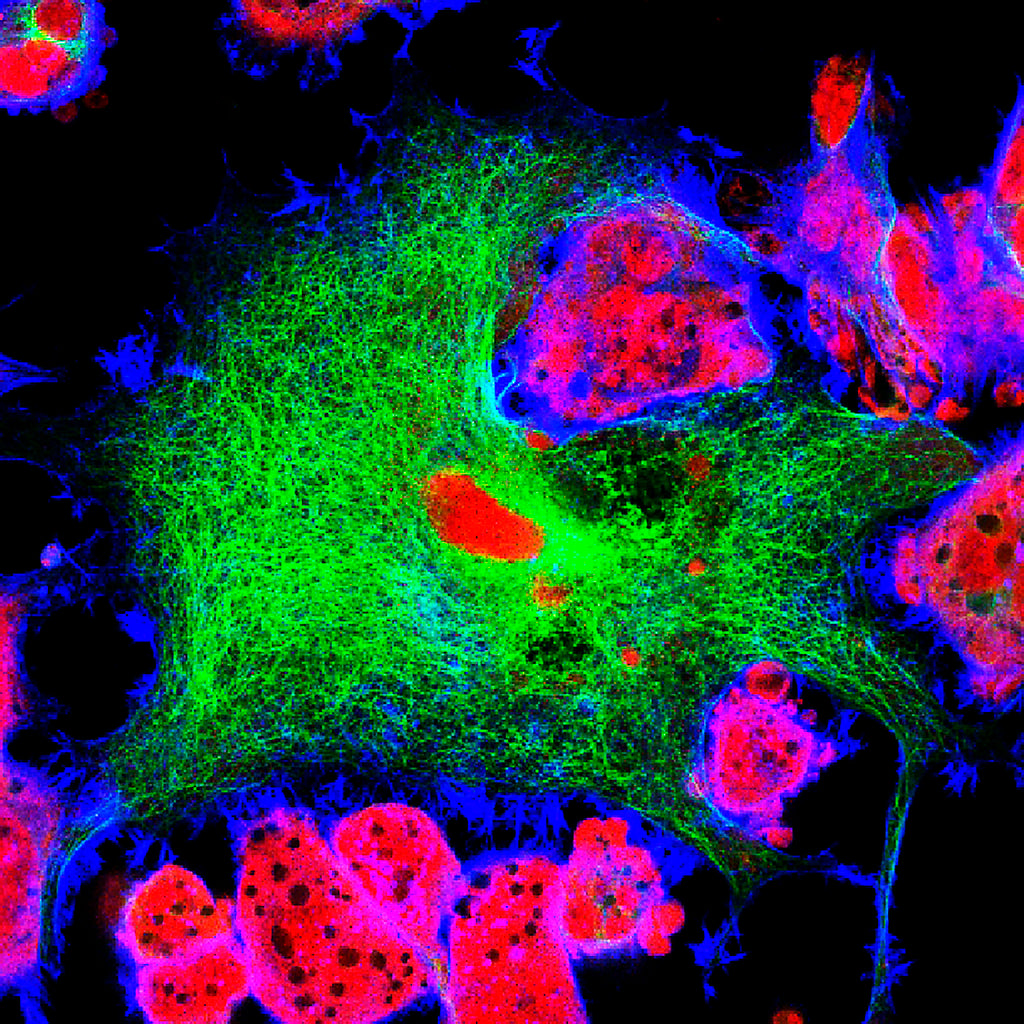 Absource Antibodies, Reagents & Assay Kits | Absource Diagnostics
