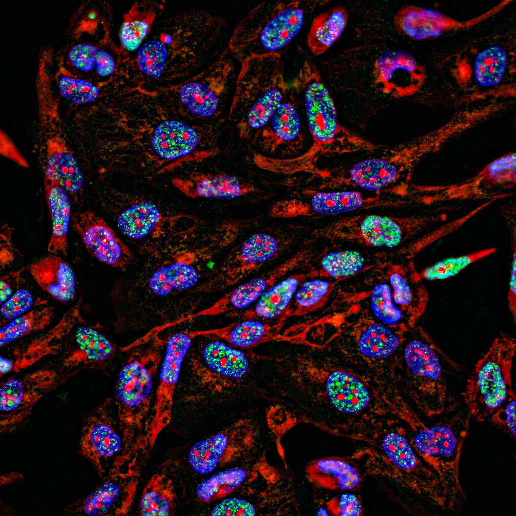 Immunohistochemistry