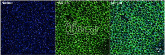 11-beta-HSD2 (HSD11B2) Antibody - Western Blot Validated