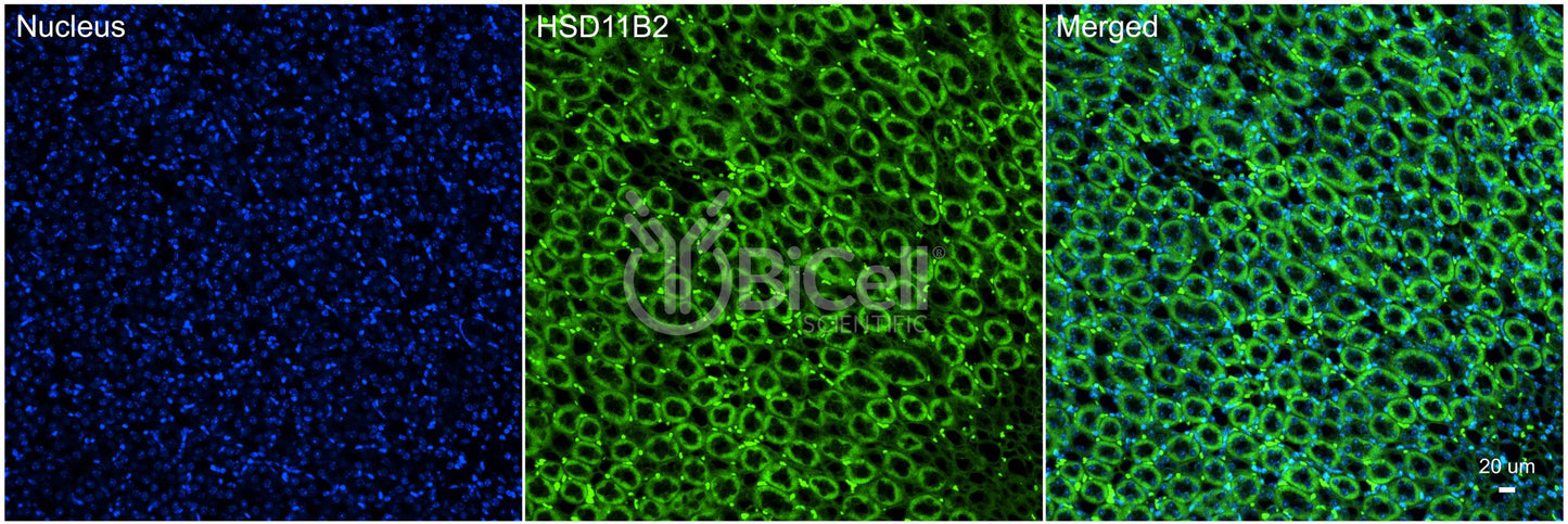 11-beta-HSD2 (HSD11B2) Antibody - FFPE Validated