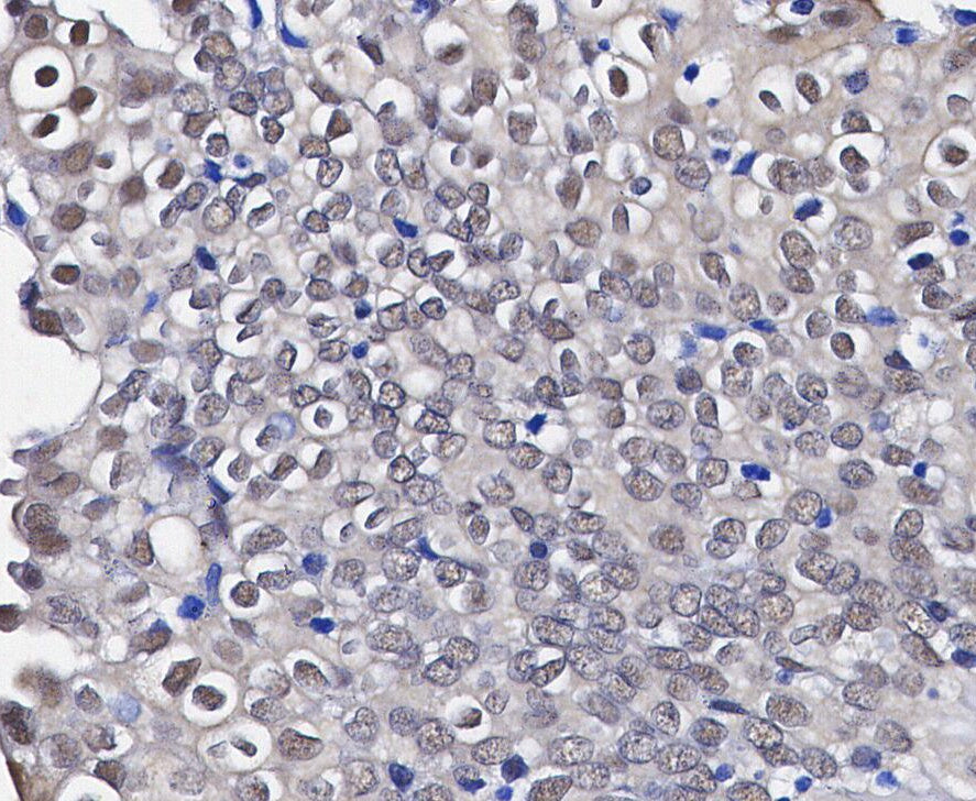 GAPDH Antibody