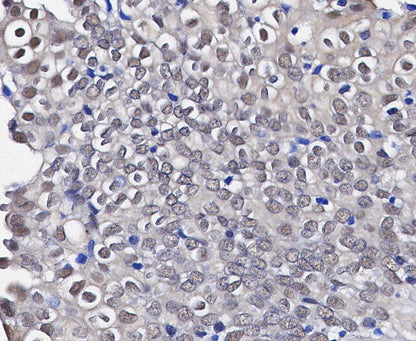 GAPDH Antibody