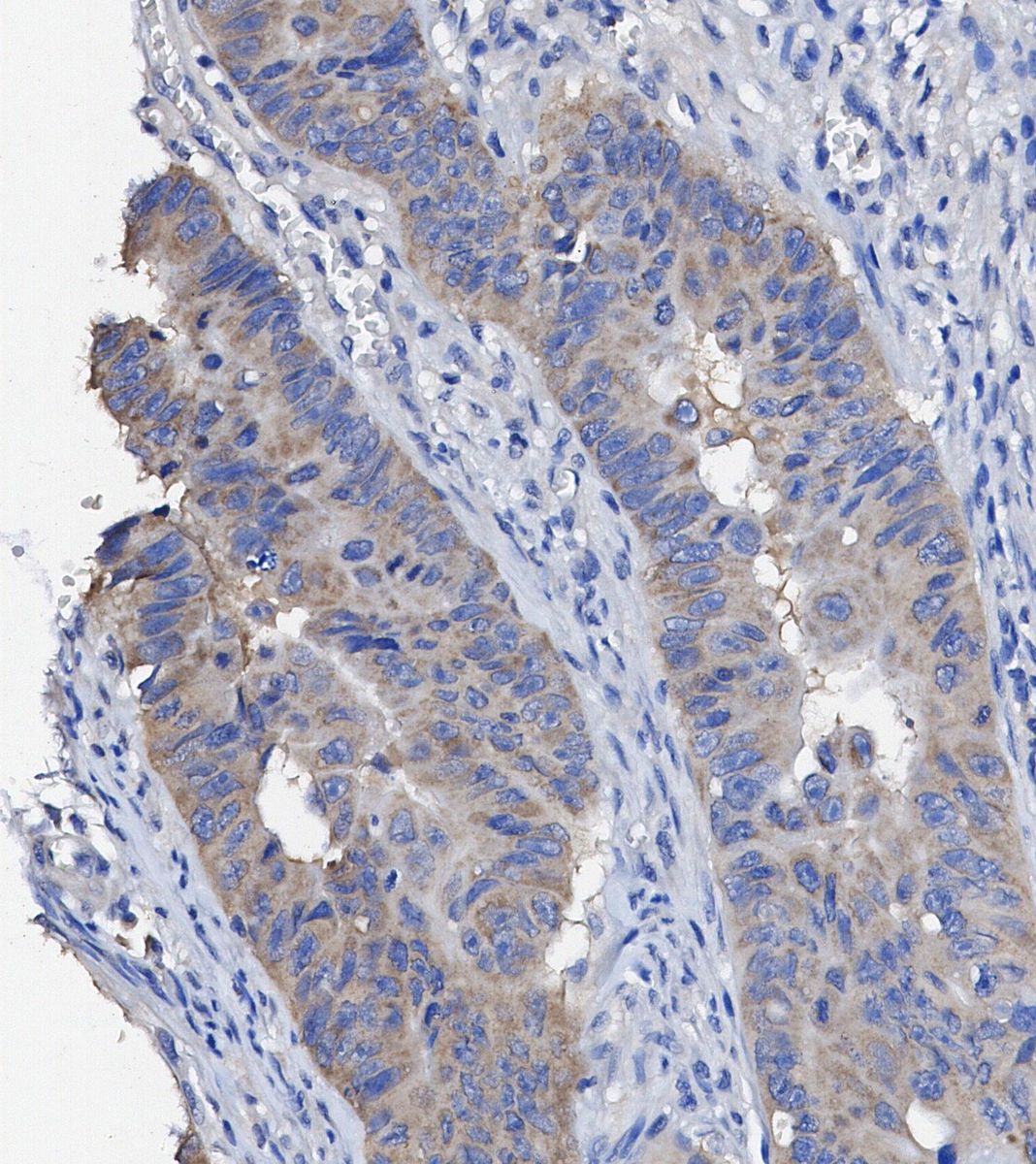 Akt (pan) Antibody