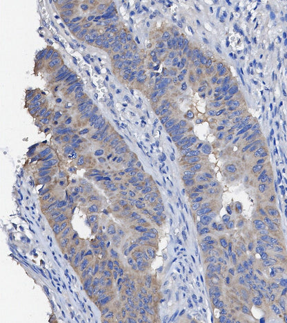 Akt (pan) Antibody