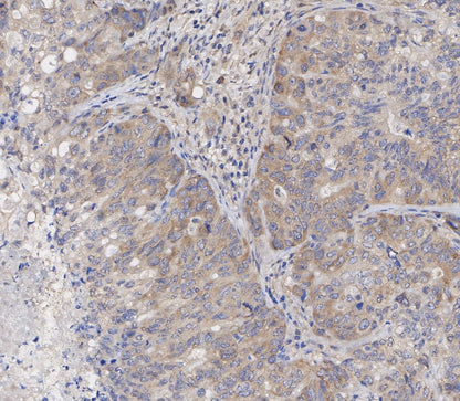 NF-κB p65 Antibody