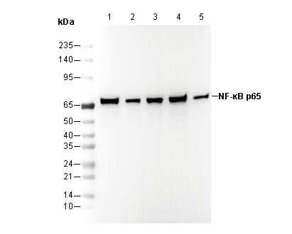 NF-κB p65 Antibody