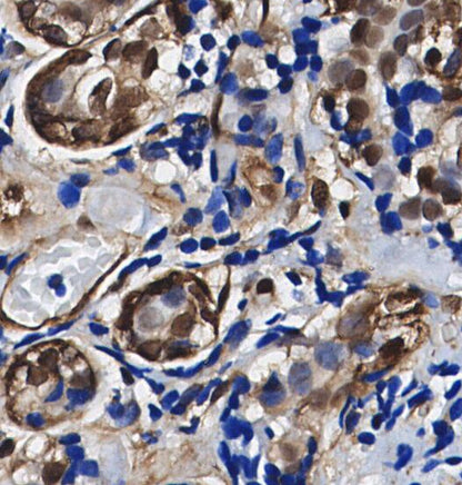 Phospho-p44/42 MAPK (Erk1/2) (T202/Y204) Antibody
