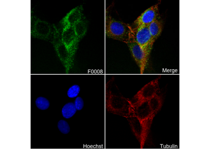 MMP9 Antibody