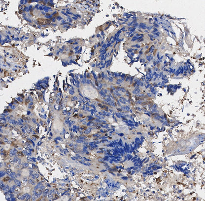 MMP9 Antibody